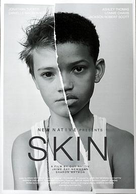 肤色 Skin 高清迅雷网盘下载